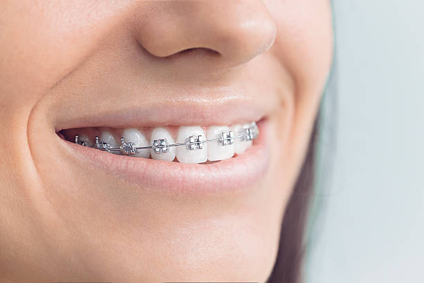 Best Traditional Braces  in New Kensington, PA
